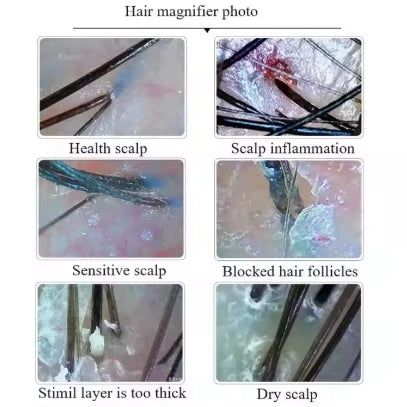 AI Pet Skin & Hair Diagnostic Scanner - HD WiFi Digital Microscope with App Analytics